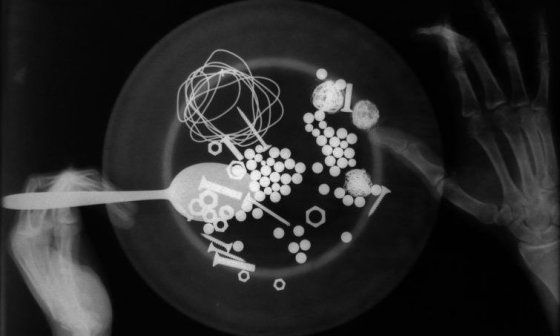 "Salud de hierro", foto de Yomer Montejo Harrys.